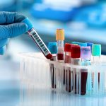 blood-tests